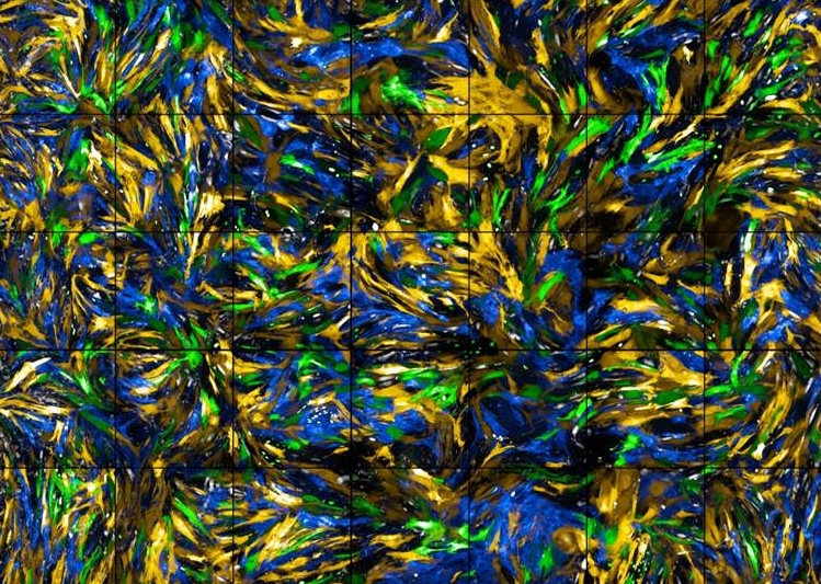 ImmyShephard's tweet photo. @TheBHF have revealed the winner of the Reflections of Research competition! ‘A Sea of Cells’, is a close-up of smooth muscle cells that surround the blood vessels in mice. It was taken by Iona Cuthbertson, PhD student @Cambridge_Uni https://t.co/srzHtGQHWG https://t.co/Rw2H2qwMjF