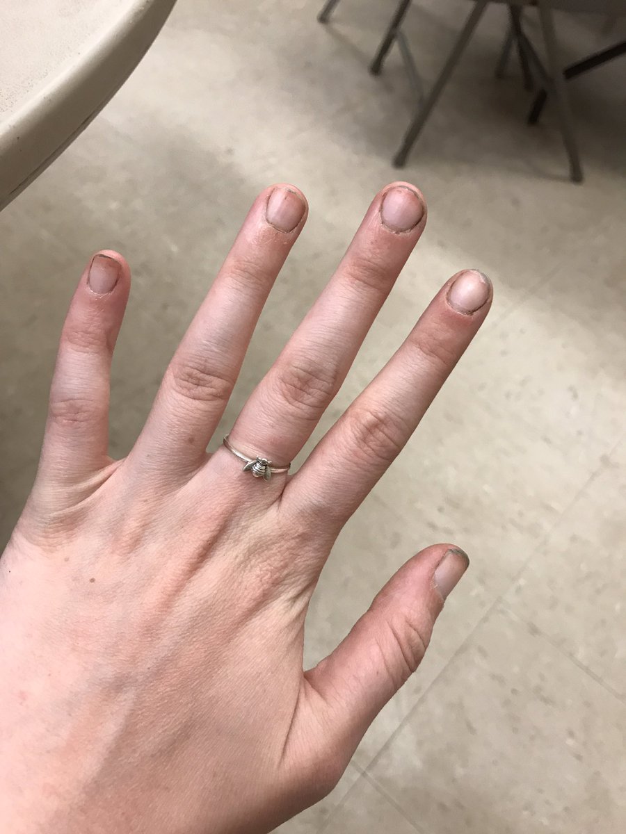 ShowMeUrPlants's tweet photo. My hands look                So hers can
     like this                       look like this https://t.co/Hs7yIYjHR3