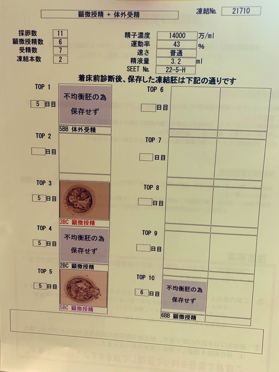 Miho 21w 神戸artレディスクリニックで着床前診断 Pgt A する場合は 神戸市内にある提携先に細胞を送っているようです てっきりポートアイランドにある機関かと思いきや 灘でした 年内にpgt Aの臨床試験対象が拡大されるけど 検査はどこでやるんだ Miho 21w 神戸artレディスクリニックで着床前診断 Pgt A する場合は 神戸市内にある提携先に細胞を送っているようです てっきりポートアイランドにある機関かと思いきや 灘でした 年内にpgt Aの臨床試験対象が拡大されるけど 検査はどこでやるんだ