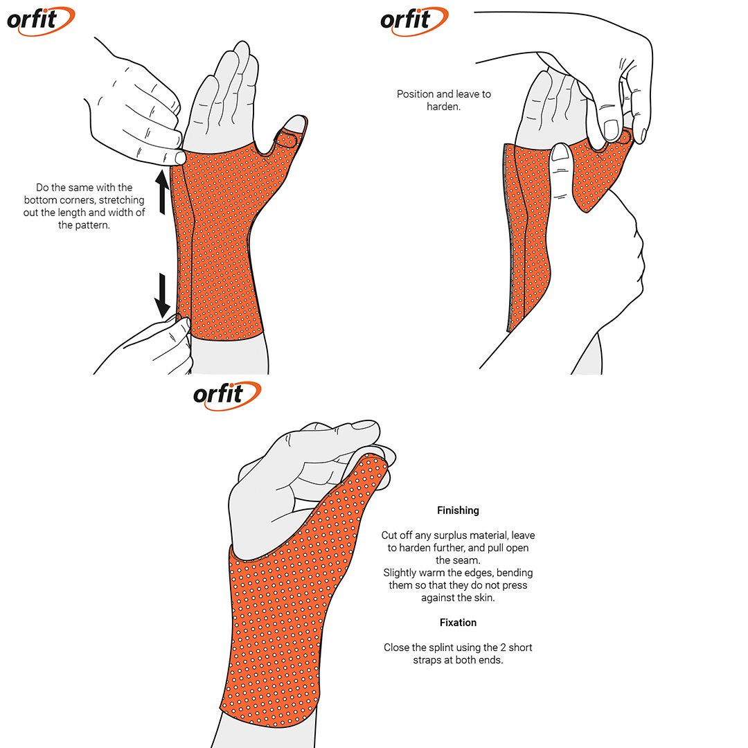 Orfit's tweet photo. A quick and easy tutorial for the long thumb orthosis. Ideal for patients with arthritis, tendinitis or a thumb sprain.
Download the complete Splinting Guide for more step-by-step tutorials >> https://t.co/GFPyxk1a1x
#arthritis #tendinitis #orfit #splintingguide https://t.co/cxF1LkujiD