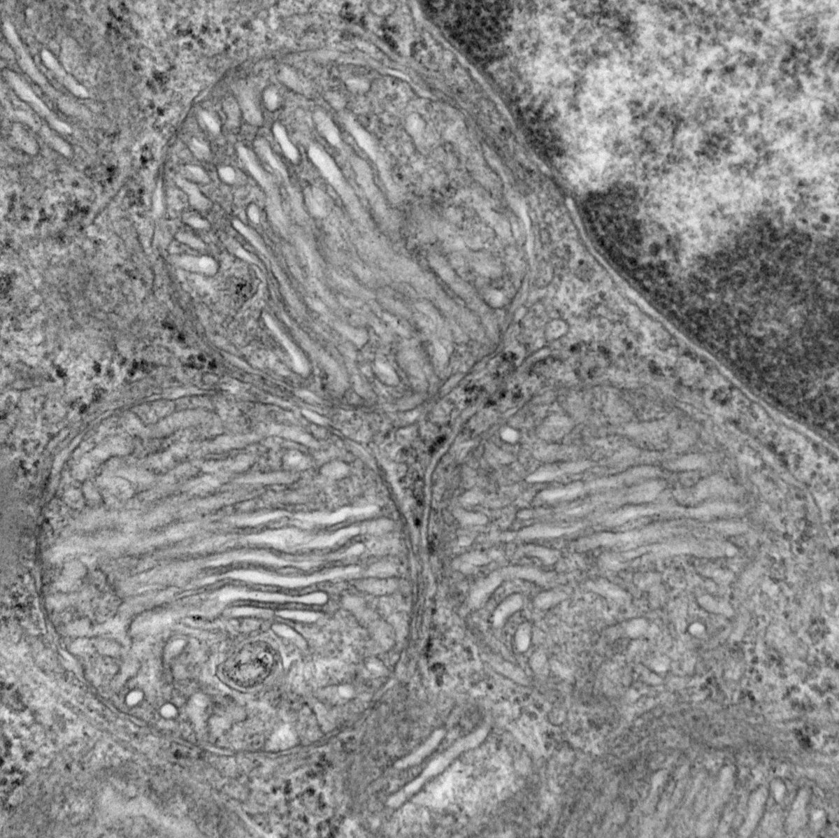 Martin Picard tweet media