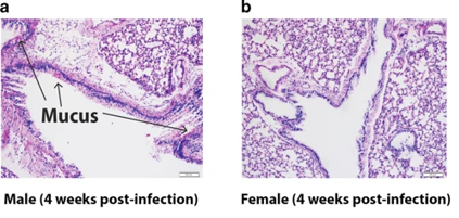 MucosalImmunol's tweet image. Nicholas Lukacs and colleagues @UMichPath show sex-associated differences in immune responses can contribute to allergic diseases following RSV infection in early life. Read more in this  #OpenAccess article: 
nature.com/articles/s4138…