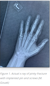 ReedTechLifeSci's tweet photo. When you sustain an injury, be an informed patient, especially when it comes to medical devices. You never know how things may turn out! See the short blog
#UDI #ReedTech #medicaldevices https://t.co/BUVtBtRTkW