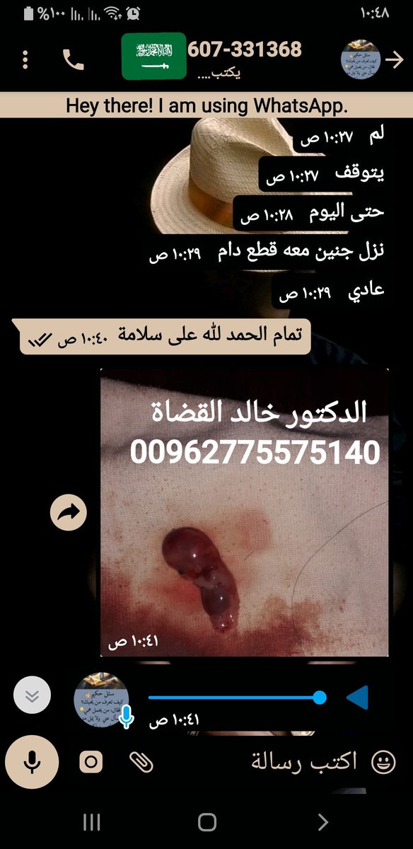 O2YJnEtDeWwUE9r's tweet photo. ترغبين في الاجهاض غير مرغوب به في حياتك الحل الافضل مضمون #حبوب_سايتوتيك
الاصلية مع مراقبة و متابعة من قبل الدكتور التسليم يد بيد الدفع عند الاستلام  تتوفر في جميع دول العالم ألاسعار مميزة 
لأمارات الكويت قطر البحرين السعودية 
التواصل عبر الواتساب
00962789541504
00962775575140 https://t.co/hrQhWTPxym