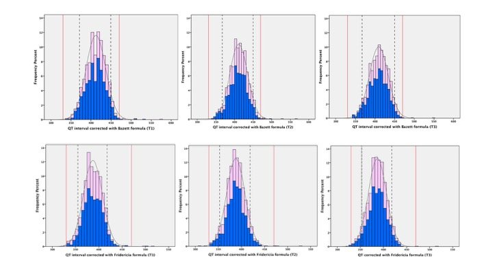 FlavioDascenzi's tweet photo. Our latest article on normal and abnormal QT interval in preadolescents and adolescents practicing sport! https://t.co/uyUlTsF2Fy
#sportscardiology #cardiologiadellosport #europace #ehra #eapc #eapcyc #cardiologiadellosportsiena #usiena #unisi #siena @unisiena @AouSenese https://t.co/Yj1cUhHMoJ
