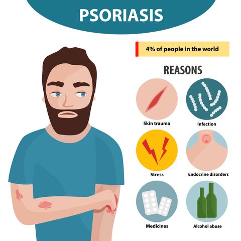 Who wants to talk about psoriasis? Not many. But it is Psoriasis Awareness Month. Find information, make donations, help others become more aware...
psoriasis.org/psa-action-mon…
#HowIThriveWithPsA #Psoriasis #PsoriasisAwarenessMonth #PsoriasisActionMonth