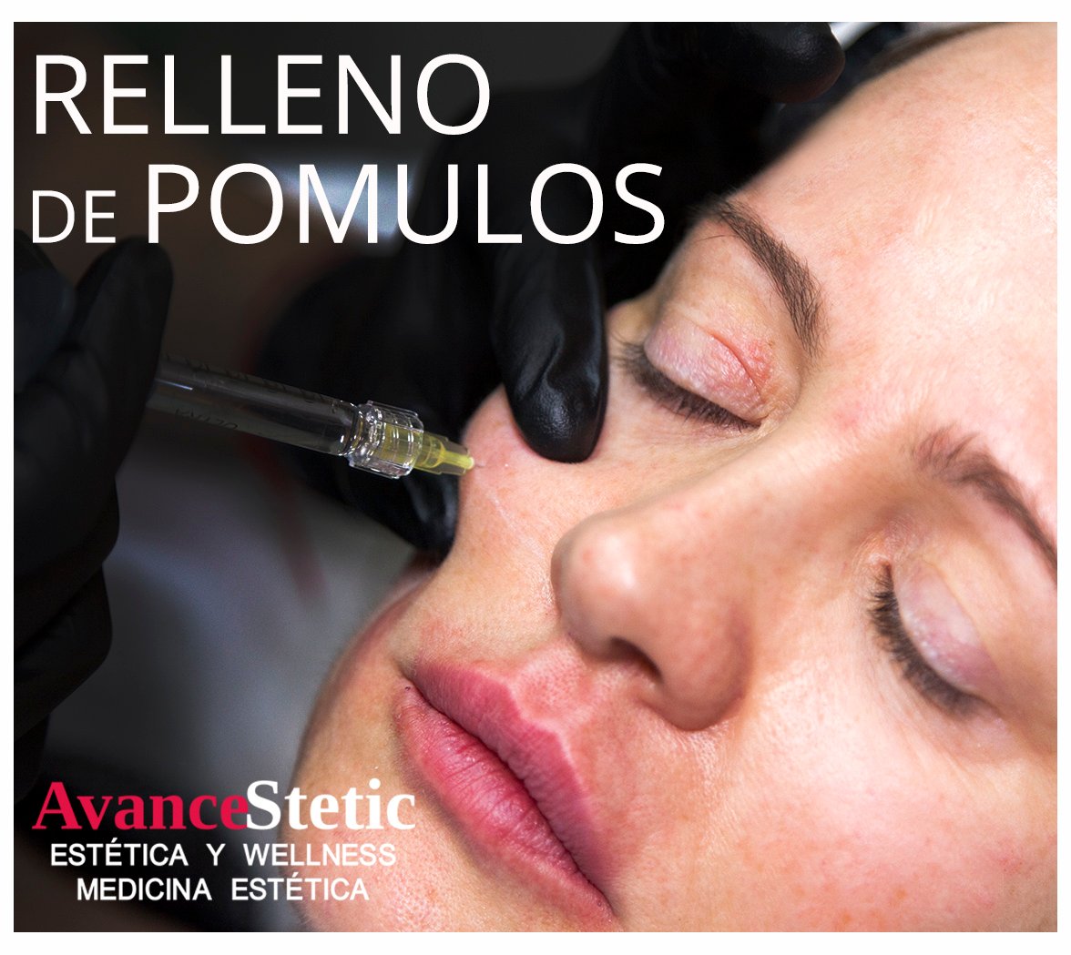 Avancestetic's tweet photo. Se aplica #ácidohialurónico en la zona de los #pómulos, se #infiltra por encima de la estructura del hueso haciendo que los tejidos que están más superficiales recuperen el #volumen perdido eliminando la flacidez.
En AvanceStetic te informamos sin compromiso
llámanos y pide cita. https://t.co/btiZ2KuKdp