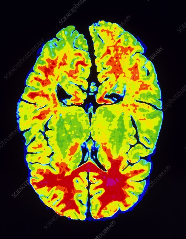 MelusinianMuse's tweet photo. Through the Looking Glass: Sensory Overload, Hypervigilance, and Neurodiversity https://t.co/TDJbyK2ZsB https://t.co/Qxn9tX4iEZ