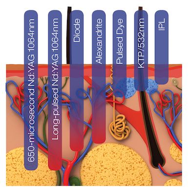 riderminstitute's tweet image. We are excited to be the FIRST dermatology office in RI to offer #aerolase.
The novel #microsecond technology avoids over-heating skin➡️eliminates treatment pain, lowers the risk of adverse effects providing several benefits➡️increased efficacy, safety and patient comfort.