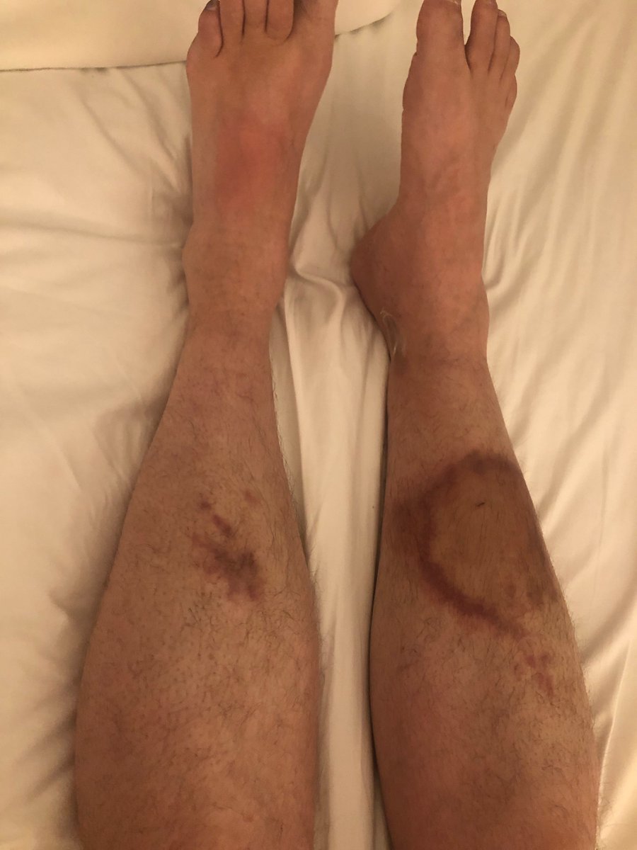 jlo450's tweet photo. @Delta Still waiting to hear from Delta regarding paying my husband's medical bills after sitting on the runway for 5+ hours (DL460 - May 26th, 2019) #CustomerService https://t.co/dWppfUF9I5
