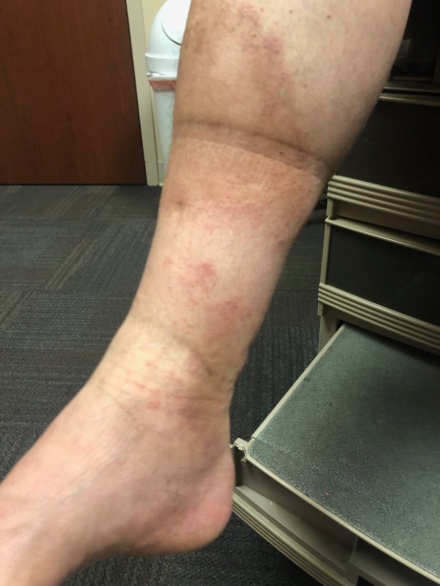 jlo450's tweet photo. @Delta Still waiting to hear from Delta regarding paying my husband's medical bills after sitting on the runway for 5+ hours (DL460 - May 26th, 2019) #CustomerService https://t.co/dWppfUF9I5