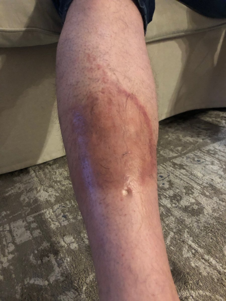 jlo450's tweet photo. @Delta Still waiting to hear from Delta regarding paying my husband's medical bills after sitting on the runway for 5+ hours (DL460 - May 26th, 2019) #CustomerService https://t.co/dWppfUF9I5