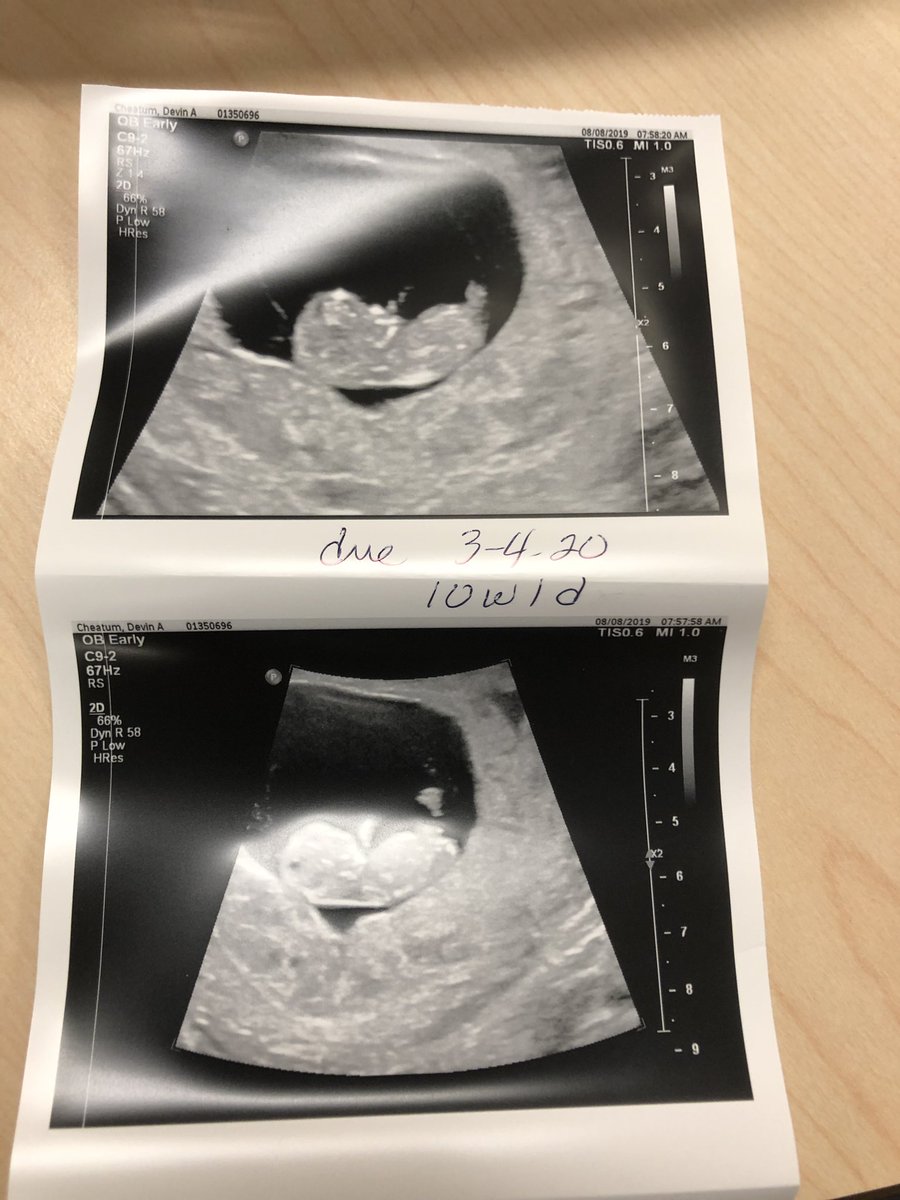 _cheatie23's tweet photo. Everything I do is for you beanie! I love you so much already! 😭😭💙💖 https://t.co/2CnXEYqBzS