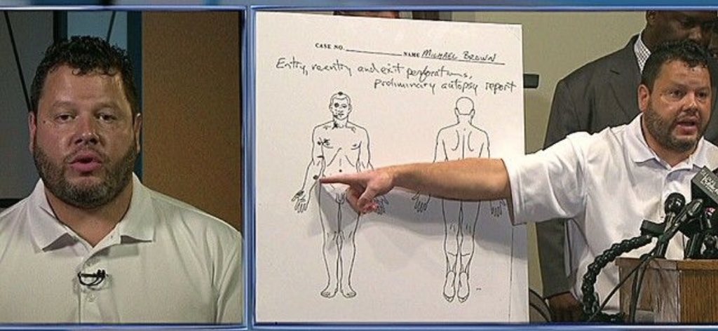 tomahawk2440c's tweet photo. @KMOV Your own paid off corrupt sad excuse for a coroner even admitted that his dead dumbass son never had his arms up! https://t.co/aRON1Pj3PR
