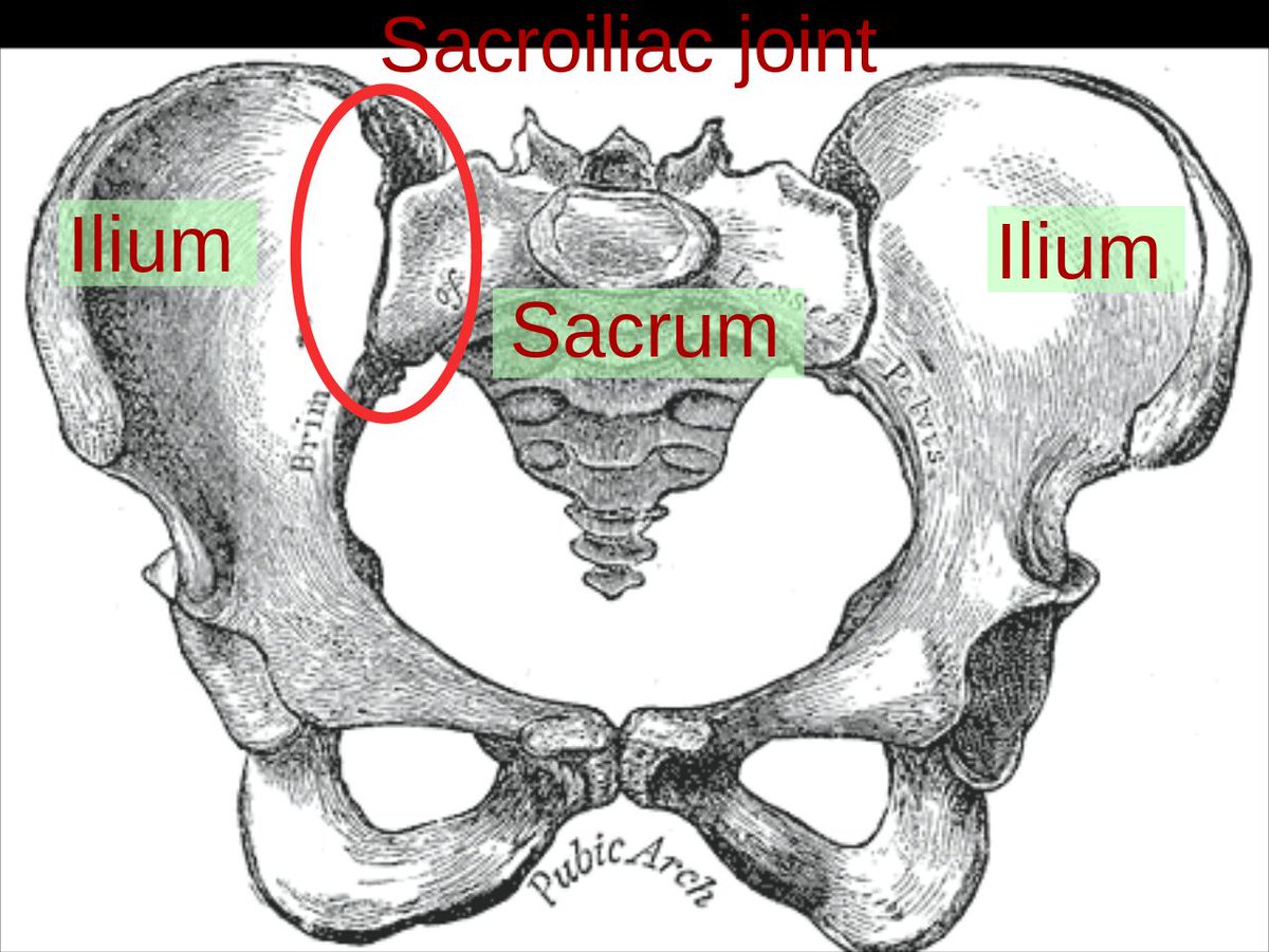 PhysioMeScience's tweet photo. Validity of Physical Exam Maneuvers in the Diagnosis of Sacroiliac Joint Pathology 

👀👆👀👇👇👇

https://t.co/Lbz6fvXp0e https://t.co/dhc2n3Gugr