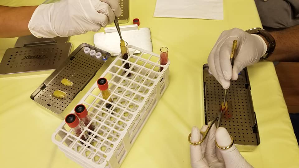 MiriamTingDMD's tweet photo. The Implant focus group of the Think Dental Learning Institute gathered this summer, July 29th or 30th to learn about evidence-based clinical applications of platelet concentrates, and to experience first hand, how to make L-PRF plugs and membranes. Fun and exciting! https://t.co/SDMNUAigoI