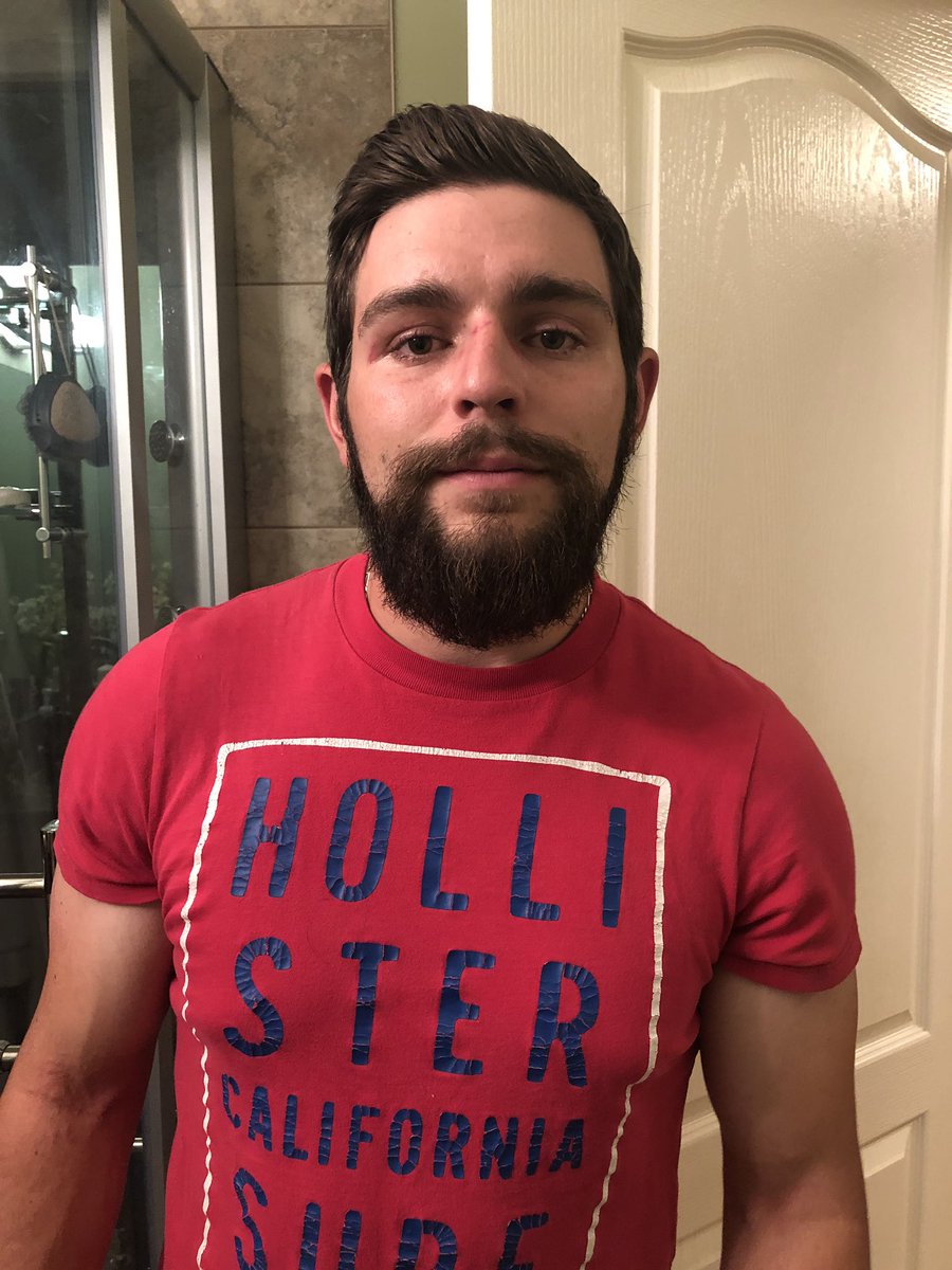 jR0WWW's tweet image. To Igor from the @StrathcoCounty Hospital in Sherwood Park:
Thanks for fixing Derek’s nose! He is able to breathe better and it’s a little straighter than before. Thanks!!! @AHS_media