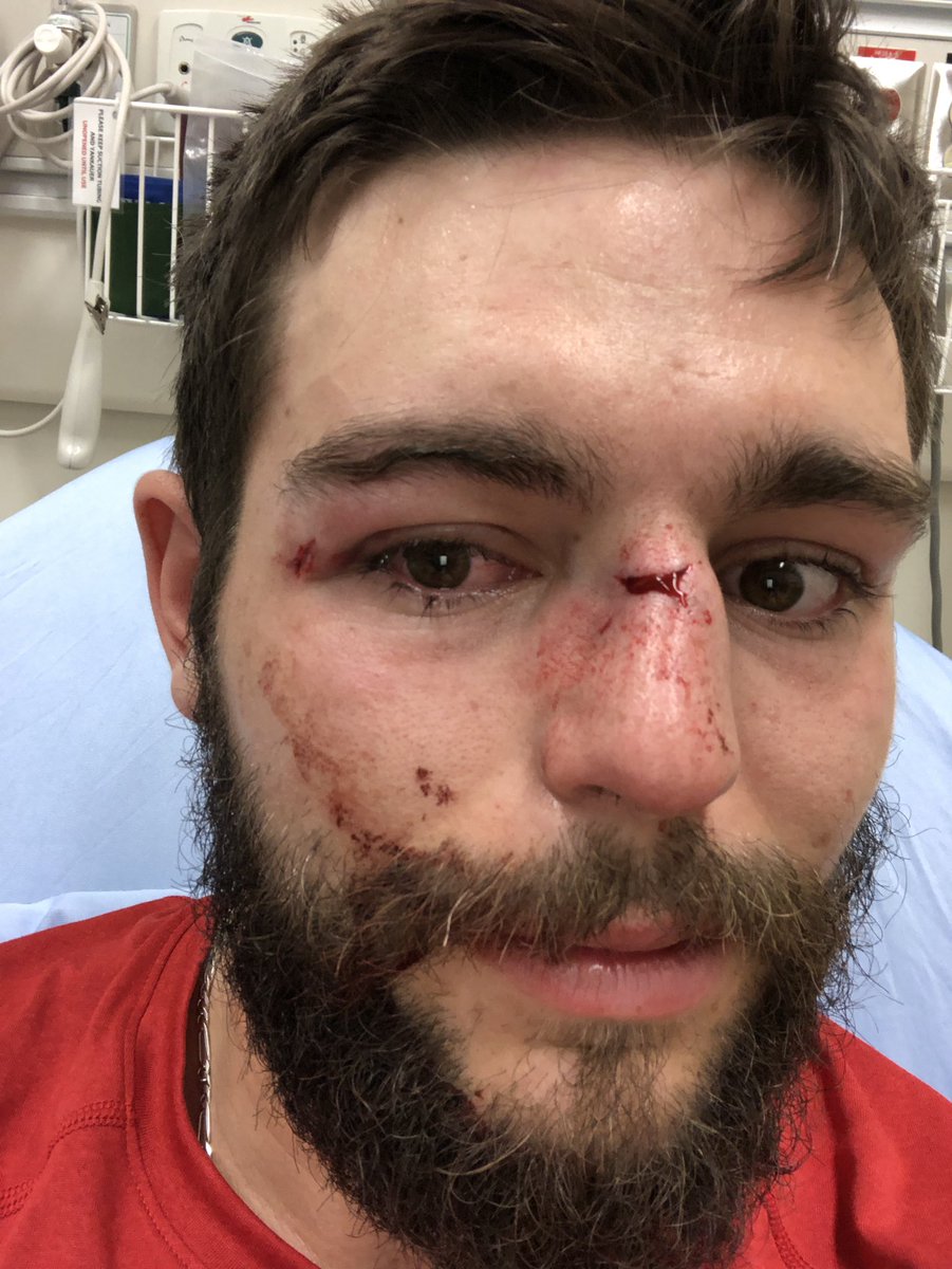 jR0WWW's tweet image. To Igor from the @StrathcoCounty Hospital in Sherwood Park:
Thanks for fixing Derek’s nose! He is able to breathe better and it’s a little straighter than before. Thanks!!! @AHS_media