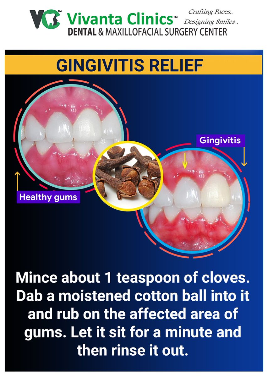 vivantaclinics's tweet photo. Gingivitis is a common issue involving redness and swelling of the gums. If not treated on time, it leads to severe oral infections.
#VivantaClinicsJaipur #OralDiseases #DentalClinic #DentalFacts #DentalTips #HomeRemedies #Braces #BrokenBraces https://t.co/av7Vdswvf1