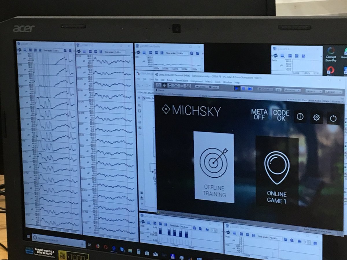 EEG during real and imagined stepping data collection today at PROGAIT study at the Physiotherapy Movement lab in UCD