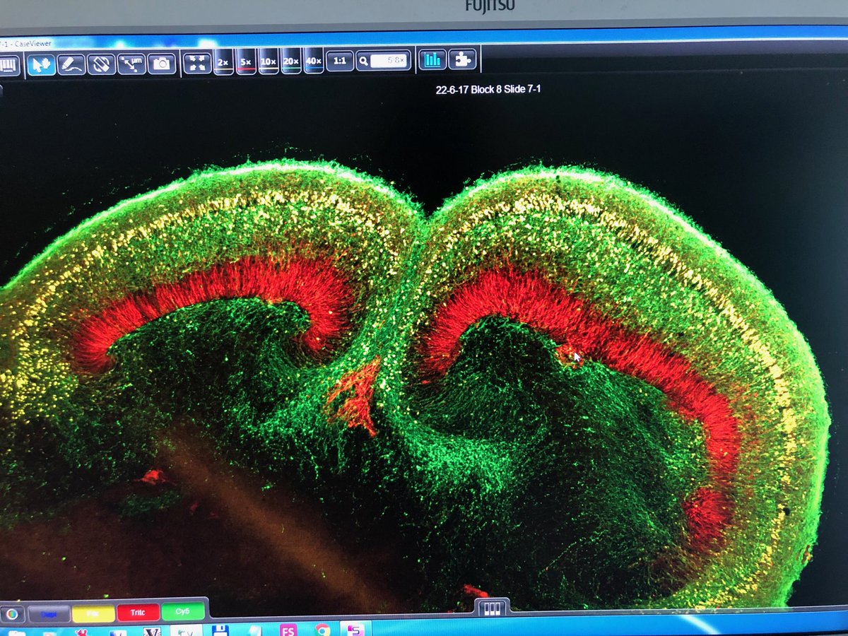 mad_lancaster's tweet photo. Just a couple of pretty cortical lobes 😍🧠 https://t.co/z0Mnxg9KEy