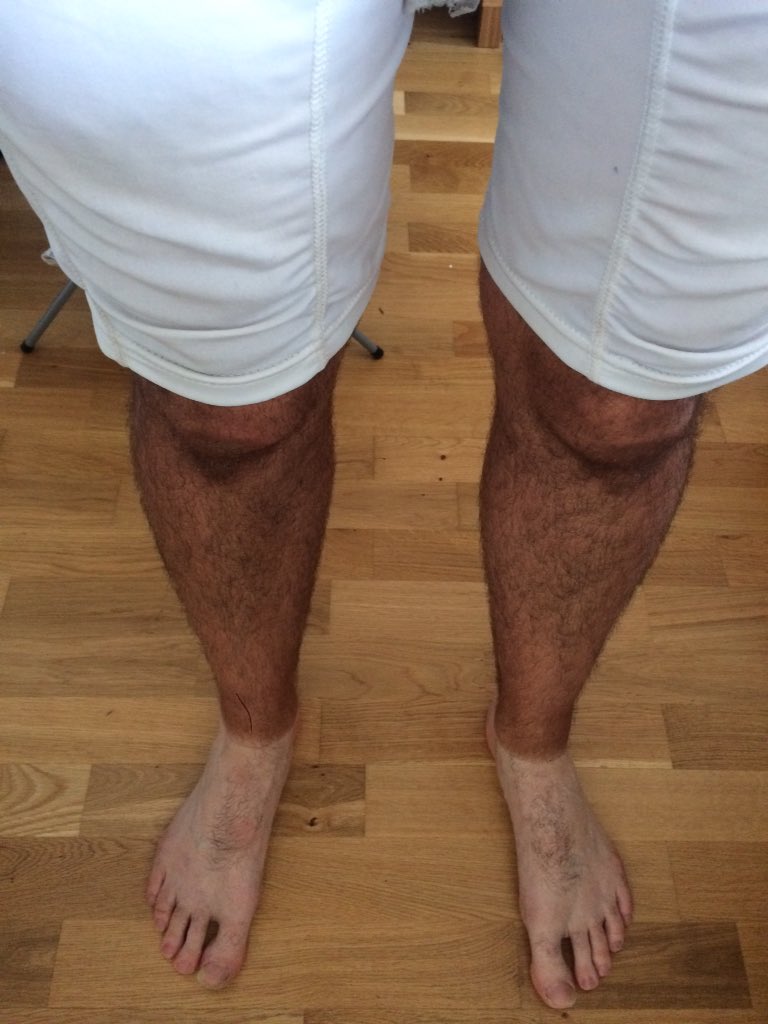 dfcricketcoach's tweet photo. Another successful @radlettcc summer camp complete! 3 weeks and over 80 boys and girls playing some great cricket through 37 degree heat and rain! What fun!!! The only casualties... One pair of trainers and some dodgy tan lines! #radlettcc #SummerCamp #tanlines #timeforabeer https://t.co/kqFto8jsxr