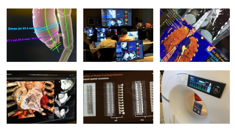 DAICpublisher's tweet photo. Image Gallery: Highlights from the Society of Cardiovascular Computed Tomography 2019 Meeting as seen through the lens of @DAICeditor. Enjoy!  https://t.co/kYKQUwcu3z @Heart_SCCT #SCCT2019 #cardiovascularCT #computedtomography #cardiacimaging https://t.co/bPW6n5TFFY