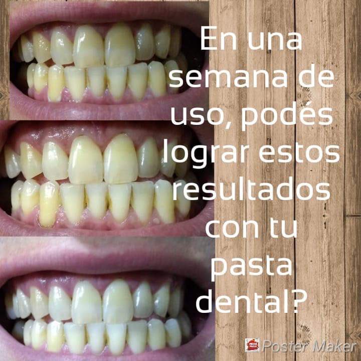 daiiegg's tweet photo. info por privado
#dientesblancos #dientes #whitening #whiteningtoothpaste #sonrinsaperfecta #sincaries #sinsarro #chaucaries #perfectsmile #argentina #chile #mexico #colombia #usa #canada #españa #europa #dentista #odontologos #avaladoporodontologos https://t.co/I9AL40TNCA