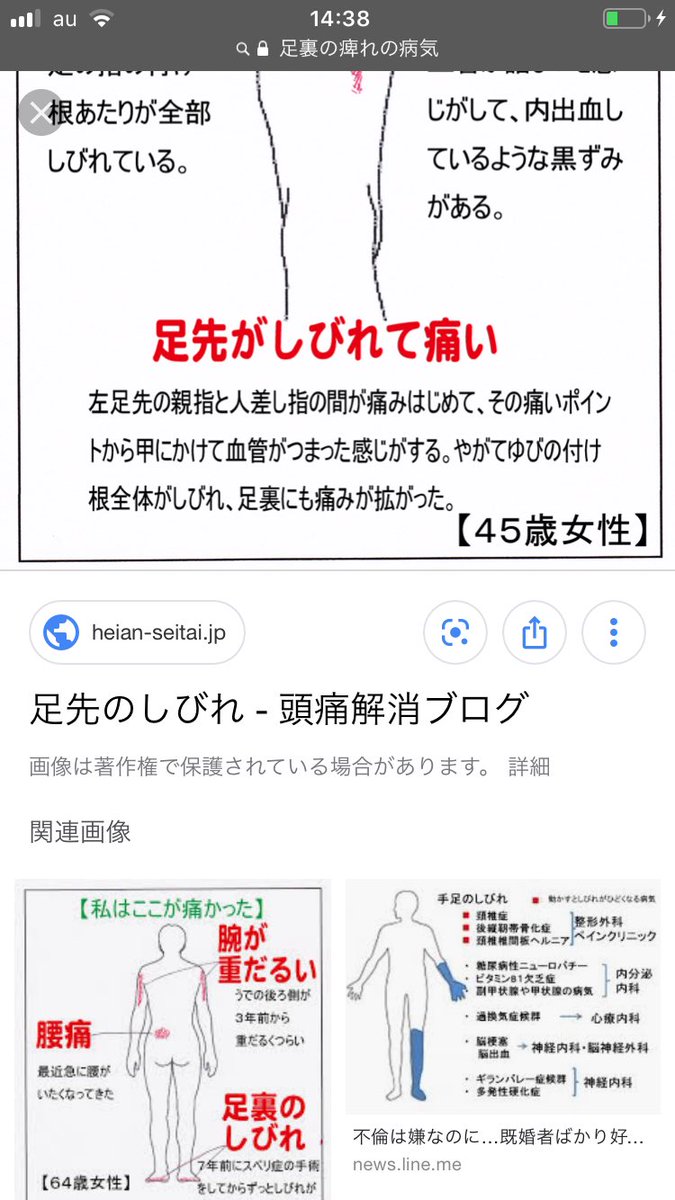 足の裏がしびれる 足の裏がしびれる