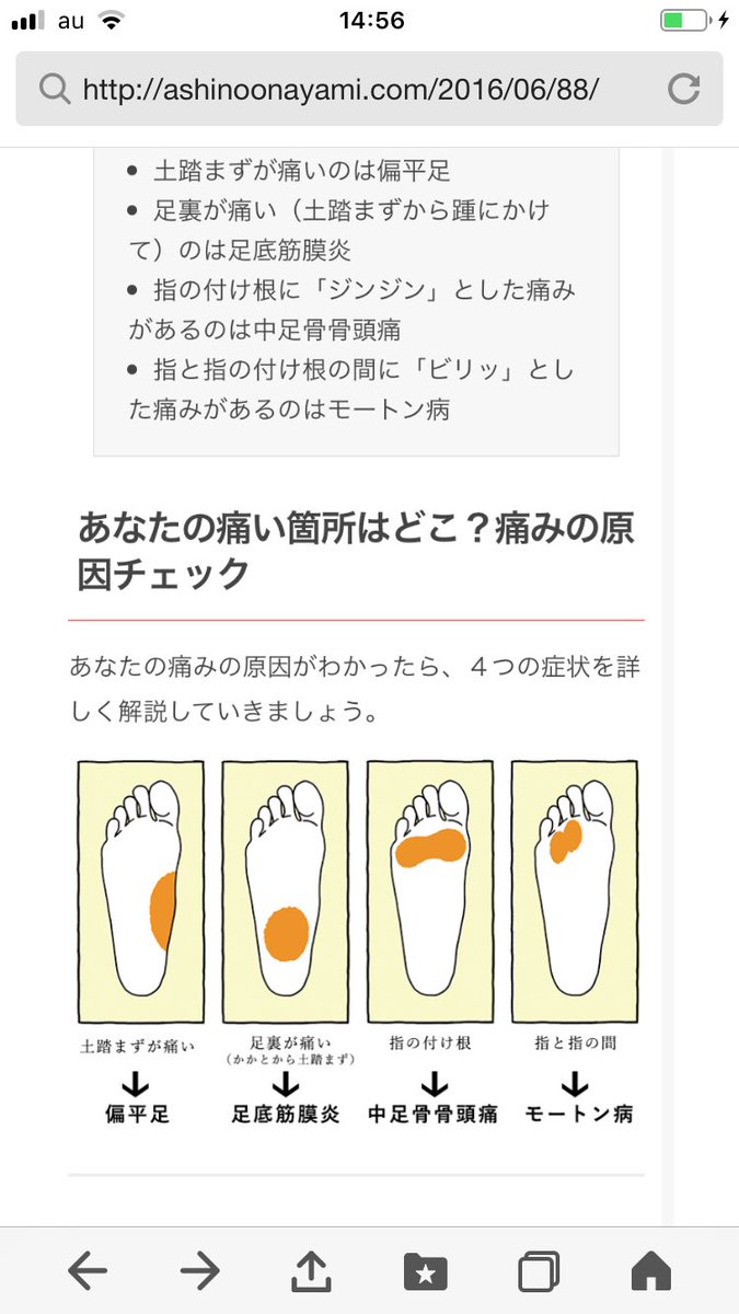 野村俊一 原因のわからない 足裏の痛み その正体は 足裏の痛みを大まかに分類 土踏まずが痛いのは 偏平足 土踏まずから踵にかけてのは 足底筋膜炎 指の付け根にジンジンとした痛みがあるのは 中足骨骨頭痛 指と指の付け根の間にビリッとした痛みがある 野村俊一 原因のわからない 足裏の痛み その正体は 足裏の痛みを大まかに分類 土踏まずが痛いのは 偏平足 土踏まずから踵にかけてのは 足底筋膜炎 指の付け根にジンジンとした痛みがあるのは 中足骨骨頭痛 指と指の付け根の間にビリッとした痛みがある