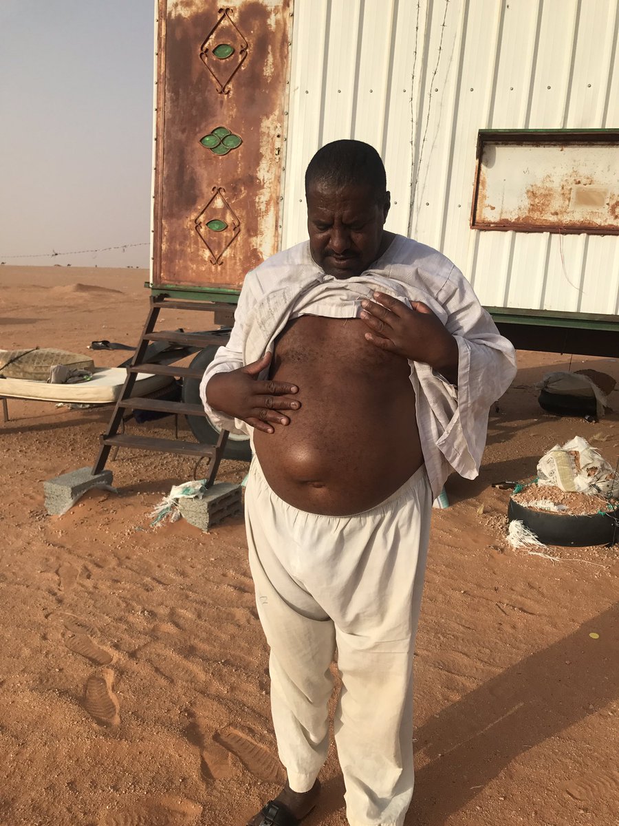 afs99a's tweet photo. (من فرج عن مسلم كربة فرج الله عنه بها كربة من كرب يوم القيامة)عامل سوداني يعمل بسوق اعلاف حفر العتش يعاني من ورم بالبطن ويحتاج عملية عاجلة ويريد السفر لبلده لإجراء العملية ولكن يوجد عليه دين بمبلغ ٦٠٠٠ ريال من مبيعات الشعير ورفض كفيله سفره حتى سداد الدين
@Rumaahh @uiiiqlc @M7wr9 https://t.co/0jHR7lrUgR