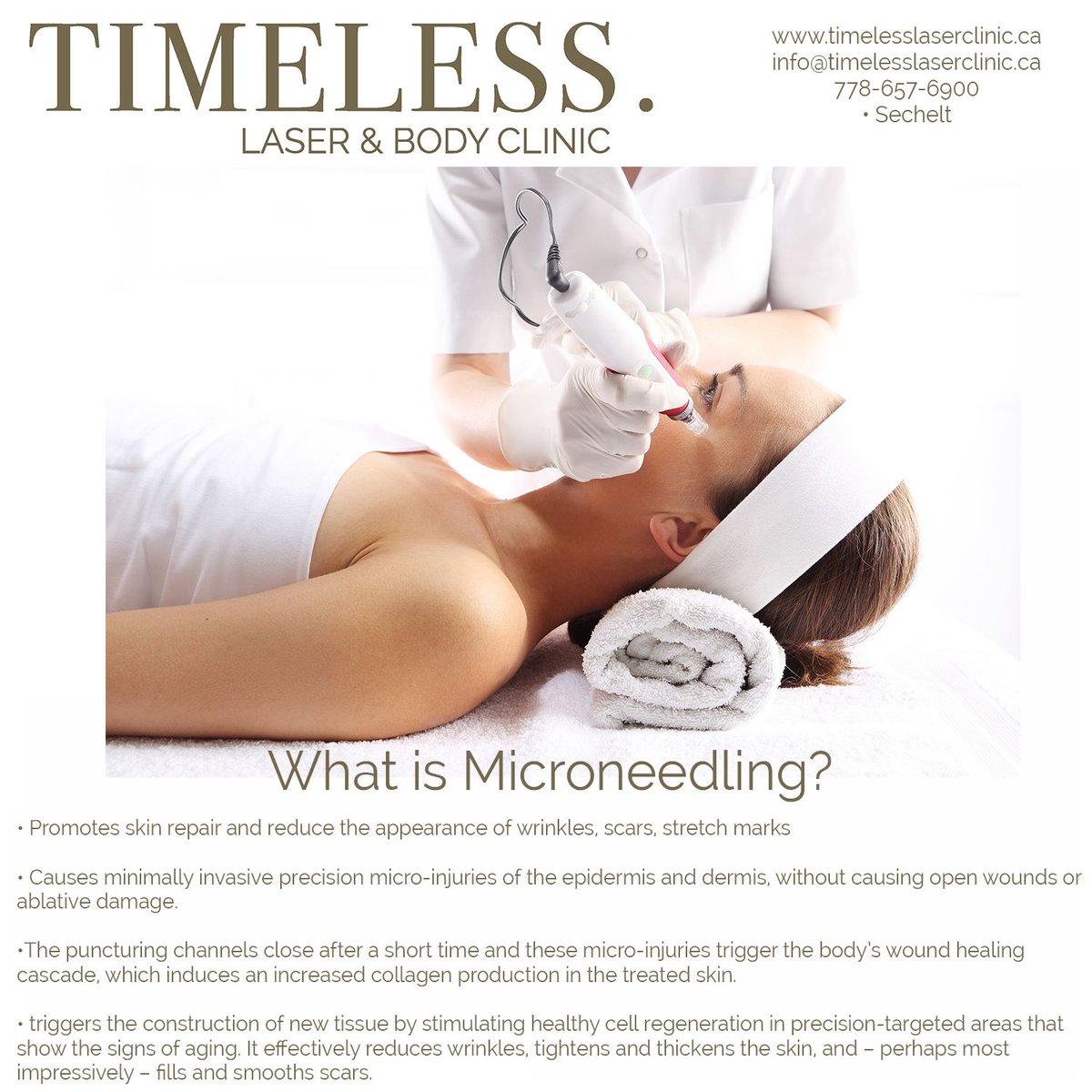 TimelessLaser2's tweet photo. We are now offering Micro Needling at our clinic! Buy a package of 3 treatments and get 25% off!
•
Micro Needling promotes skin repair and reduces the appearance of wrinkles, scars and stretch marks.
Call to book!
#Sechelt #SunshineCoastBC #microneedling #microneedlinginsechelt https://t.co/2OofOR83pD