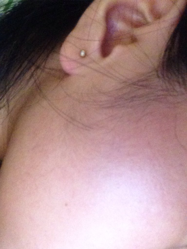 ashistrr's tweet photo. Gusto nyo clear skin? Ako din, gusto kita. https://t.co/vE0qxvTNTX