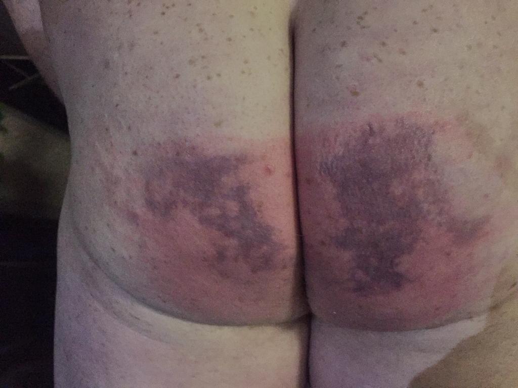 Bottom2Baton's tweet photo. 10 strokes of the #clacken delivered at full force by the amazing @mistress_baton in a school roleplay 💥💥💥 https://t.co/z9nTXTYSIW