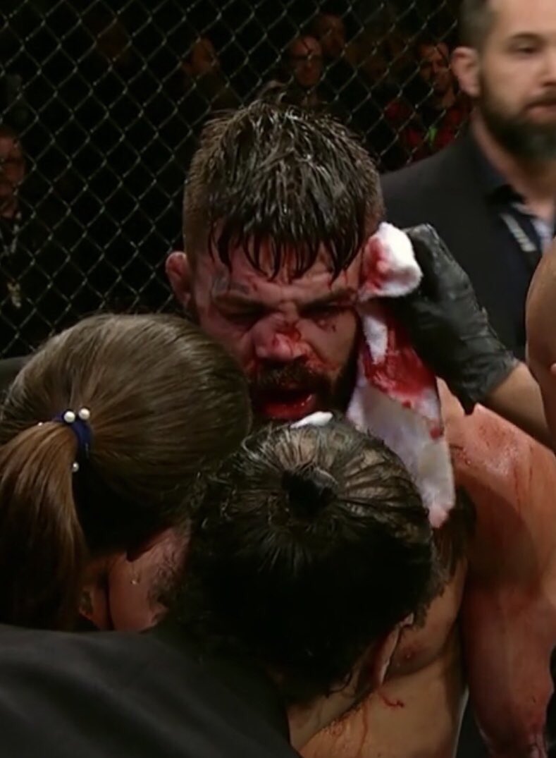 AlessioDiNardo1's tweet photo. Rip to like everycunt who fought on #UFCUruguay
#Violence #deed #smackbang https://t.co/NAH3UooCmn