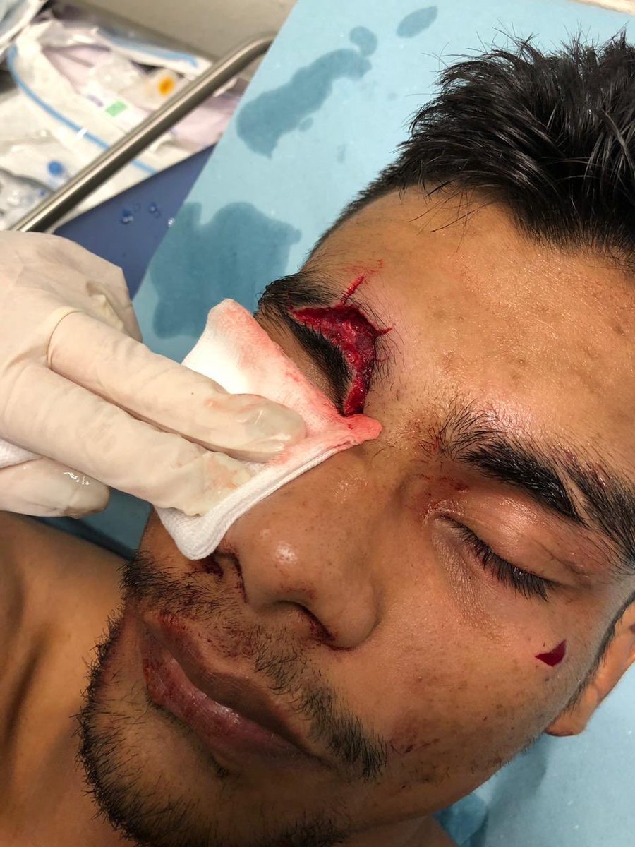 AlessioDiNardo1's tweet photo. Rip to like everycunt who fought on #UFCUruguay
#Violence #deed #smackbang https://t.co/NAH3UooCmn