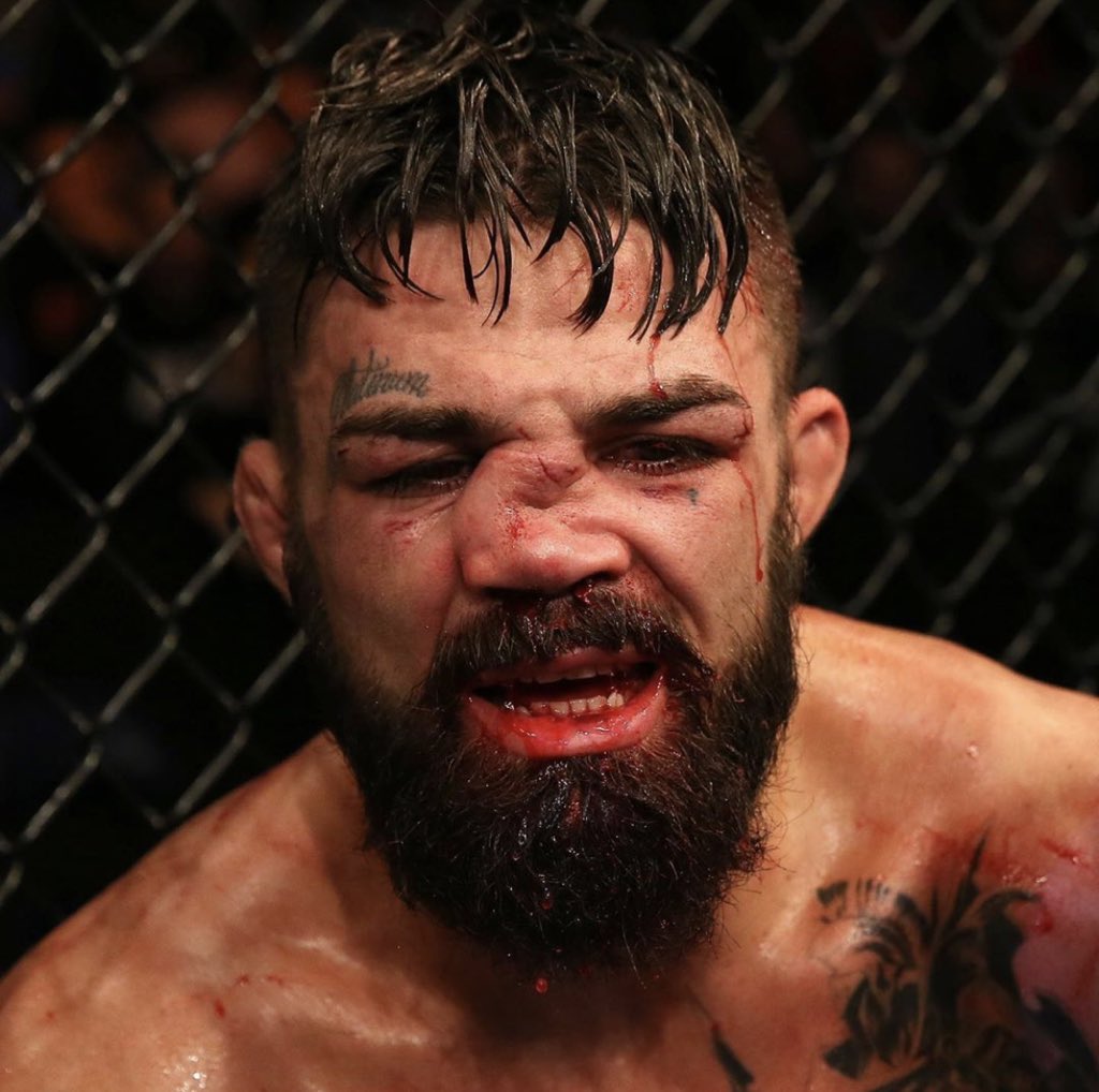 Every time I’m tempted to get in the octagon I see something like this, and I’m like, “Nah, I’m good.”