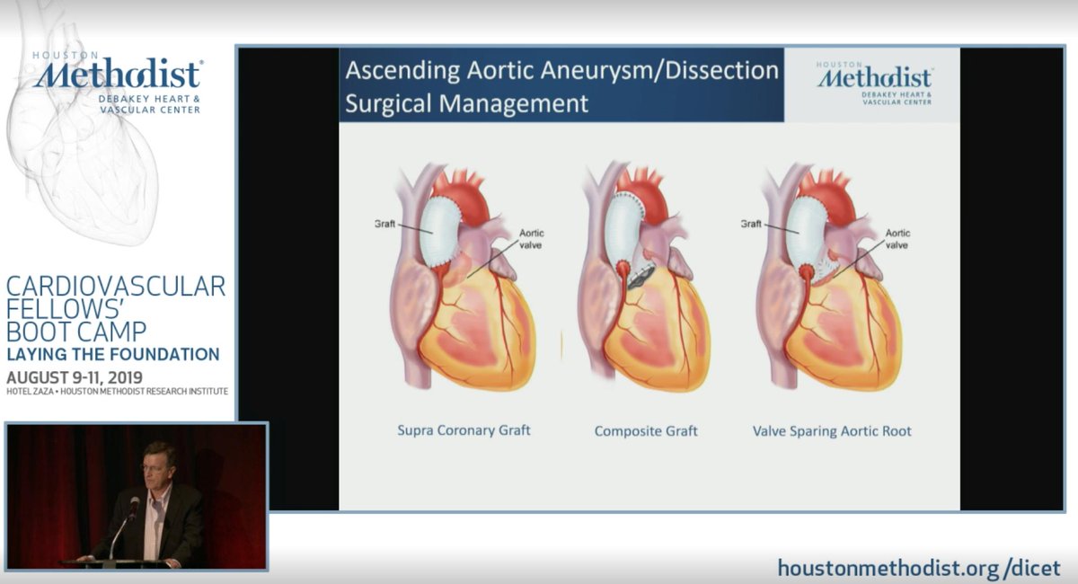 HuieLin's tweet photo. @NadeenFaza @ACCCardioEd @ACCinTouch @ChamsiPash @HMethodistCV @WilliamZoghbi @DICET_DeBakey @almallahmo @rooshaparikh DrTomMacGillivray teaching on #ThoracicAorticDisease #CVBootCamp19 : Aortic Dissection = 1-2% mortality/hour! Diagnosis/Prevention/EarlyIntervention @MarfanFdn @STS_CTsurgery @atscommunity https://t.co/epUkBPWxBW