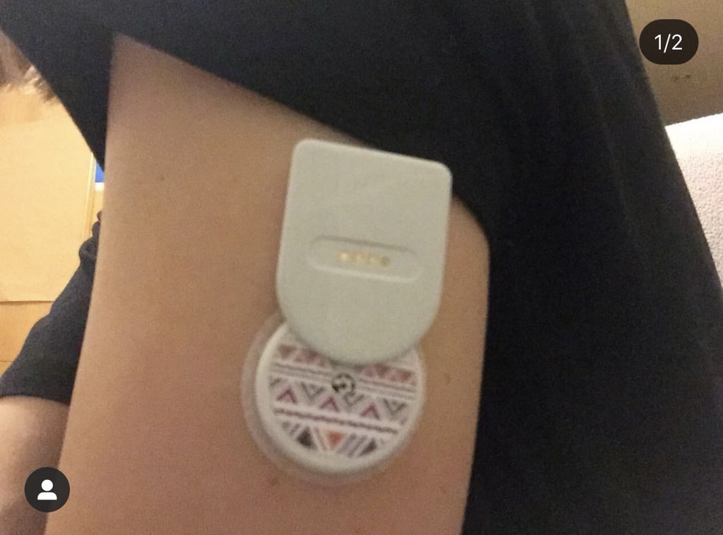 High_Brilliant_'s tweet photo. @tantoquecontarnos👍👍👍 #freestylelibre #abbotfreestylelibre #t1diabetes #t1d #t1dlookslikeme #type1diabetic #typ1d #type1 #typeone #typeonekids #typeonediabetes #diabeauty #diabetes #diabeteslife #t2d #type1strong #miaomiao_smart_libre_reader https://t.co/QAOPDvPPqJ