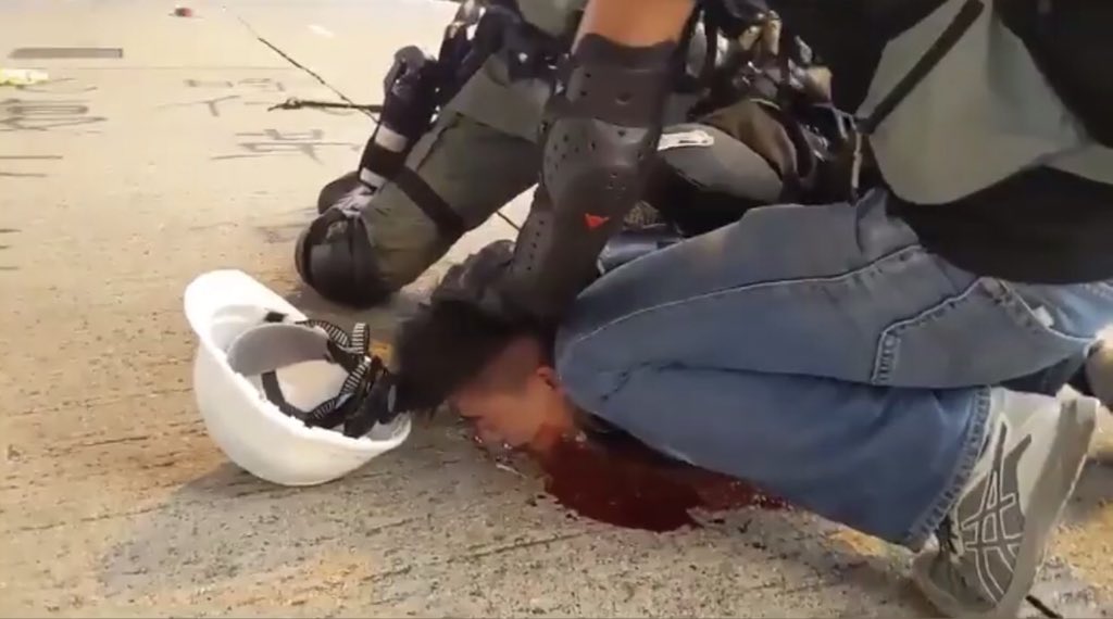 Protester51's tweet photo. Hong Kong police attempt to murder Hong Kong citizens.
Feeling heartbroken and helpless.
#antiELAB #freedomhk #savehk #prayersforhk #HongKongProtest #hongkong #AntiExtraditionBill
 @BBCBreaking @BBCWorld @BBCNews @cnni @CNN @japantimes @guardian https://t.co/RRSR6zGMgx