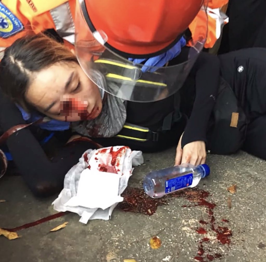 Protester51's tweet photo. Hong Kong police attempt to murder Hong Kong citizens.
Feeling heartbroken and helpless.
#antiELAB #freedomhk #savehk #prayersforhk #HongKongProtest #hongkong #AntiExtraditionBill
 @BBCBreaking @BBCWorld @BBCNews @cnni @CNN @japantimes @guardian https://t.co/RRSR6zGMgx
