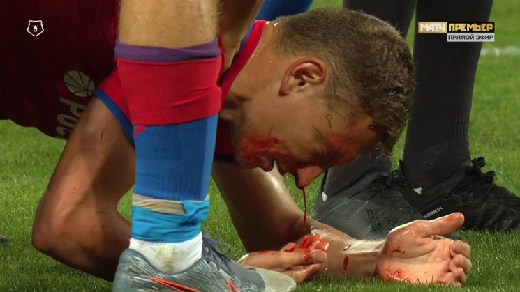 FootRusse's tweet photo. Pas de but dans ce #CSKASochi mais de nouveau un scandale avec ce coup de coude sur Chalov! Le sang a coulé!! #CSKA https://t.co/BaR9oAUBWu
