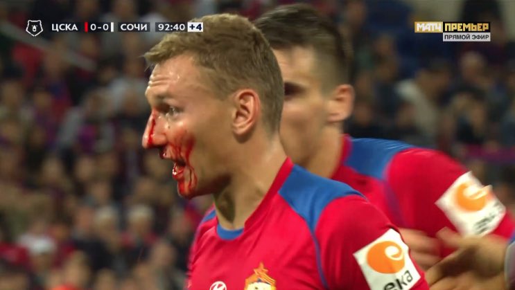 FootRusse's tweet photo. Pas de but dans ce #CSKASochi mais de nouveau un scandale avec ce coup de coude sur Chalov! Le sang a coulé!! #CSKA https://t.co/BaR9oAUBWu