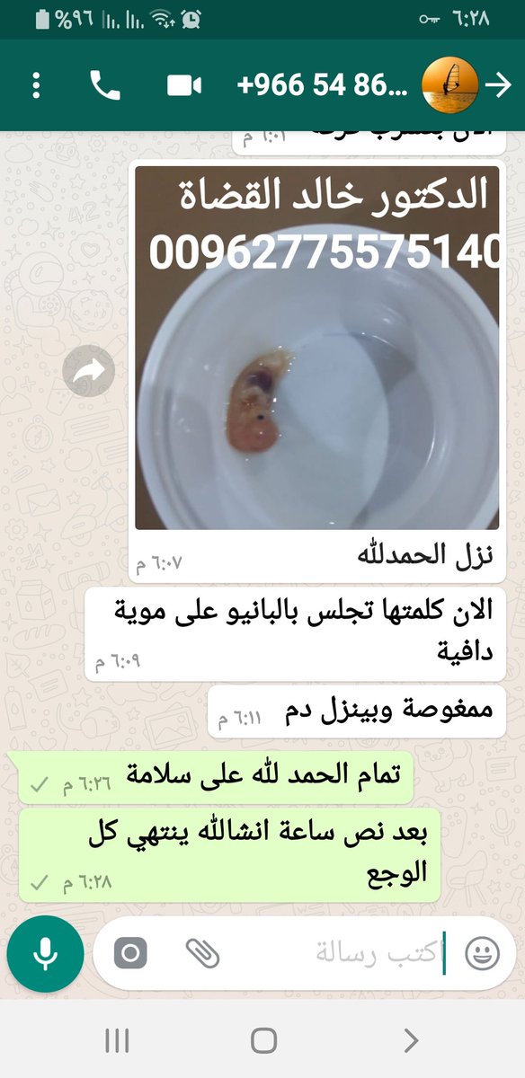 O2YJnEtDeWwUE9r's tweet photo. ترغبين في الاجهاض غير مرغوب به في حياتك الحل الافضل مضمون #حبوب_سايتوتيك
الاصلية مع مراقبة و متابعة من قبل الدكتور التسليم يد بيد الدفع عند الاستلام  تتوفر في جميع دول العالم ألاسعار مميزة 
لأمارات الكويت قطر البحرين السعودية 
التواصل عبر الواتساب
00962789541504
00962775575140 https://t.co/5wuU8auGG2