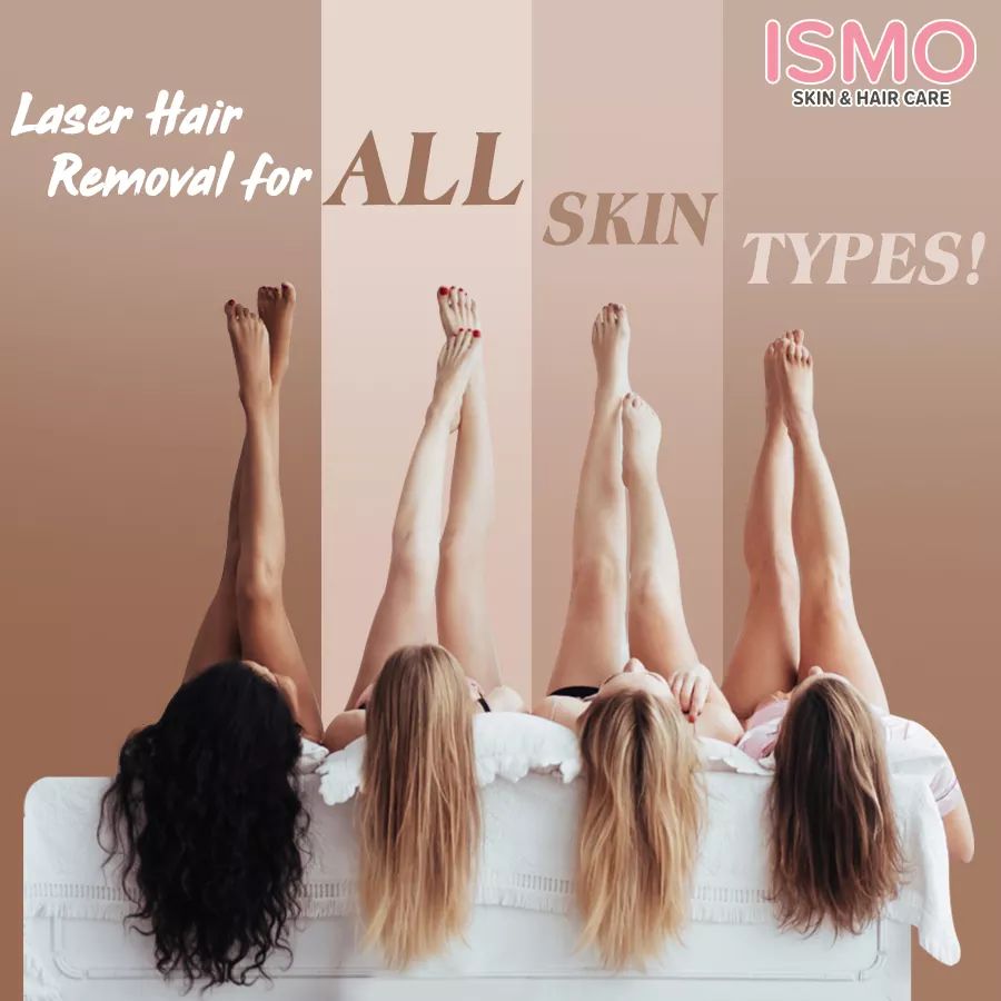 Ismoclinic's tweet photo. Dark, wheatish or whatever may be your skin tone, we have the best laser hair removal treatment for you. Visit ISMO skin and hair care for the best outcome. To book appointments, call 044-24660222 

#ismo #skincare #skintone #laser #laserhairremoval #treatment #skintreatment https://t.co/38uFupAhau