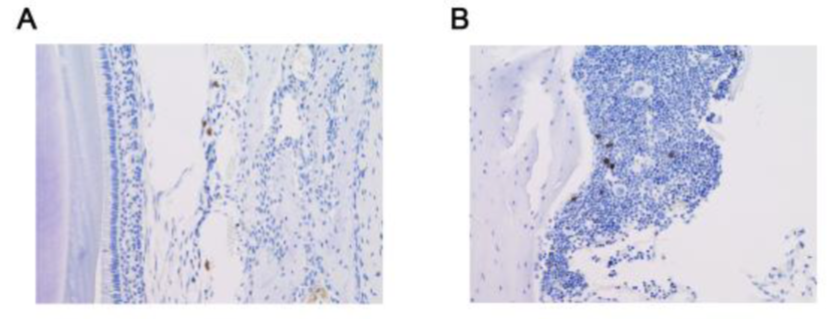 PMIJournal's tweet photo. Acetylshikonin has long been known as an #antiinflammatory and #antioxidative reagent. However, the anti‐#allergic effect hasn't been studied. This new study in #APMIS aims to evaluate the effect of #acetylshikonin on allergic rhinitis in mice
https://t.co/F1rnf9Mohf https://t.co/z4SdPWNpiD