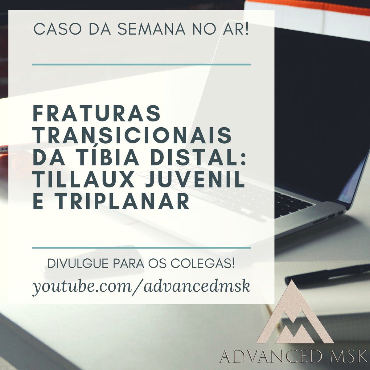 Segunda é dia de “caso da semana”! Está no ar, com o tema “fraturas transicionais da tíbia distal: tillaux juvenil e triplanar”, confira e compartilhe com os colegas!
youtu.be/RcIVNYeKAOc