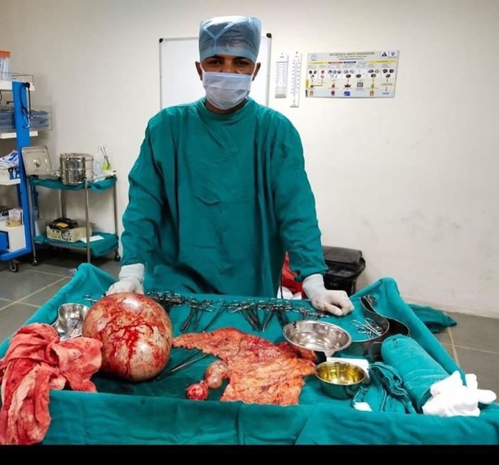 WOMSoffical's tweet photo. 10 kg ovarian tumour
in 40 years women
Rohit Rathee🇮🇳

#ovariantumor #surgeon #ot #doctor #india #ovariancancer #women #MondayMorning #hospital #indiadoctor #AA19 #370Article #DreamGirlTrailer #anxiety #NursesActive #nurse #SurbhiChandna #worldofmedicalsaviours https://t.co/nR8yLA6UHw