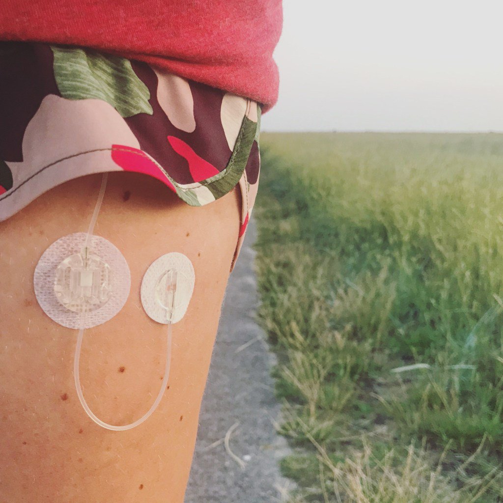 Diabetes Blog Woche 2019 – Was verstehe ich unter Diabetes Heilung? mein-diabetes-blog.com/diabetes-blog-…