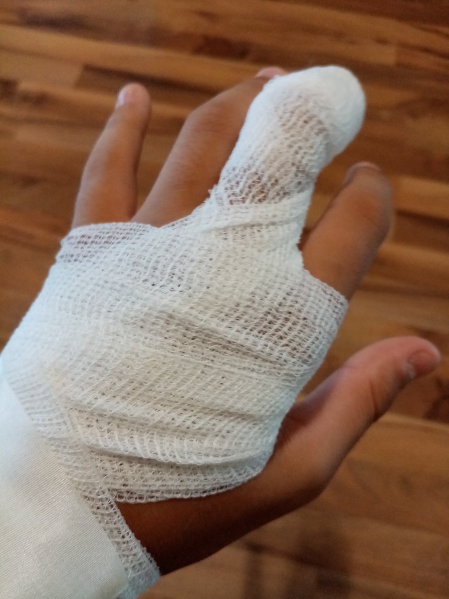 orangetime13's tweet photo. Letzt Woche war ich im Krankenhaus wegen meinem Fuß jetzt sowas 😜 https://t.co/xREu5t7CRb